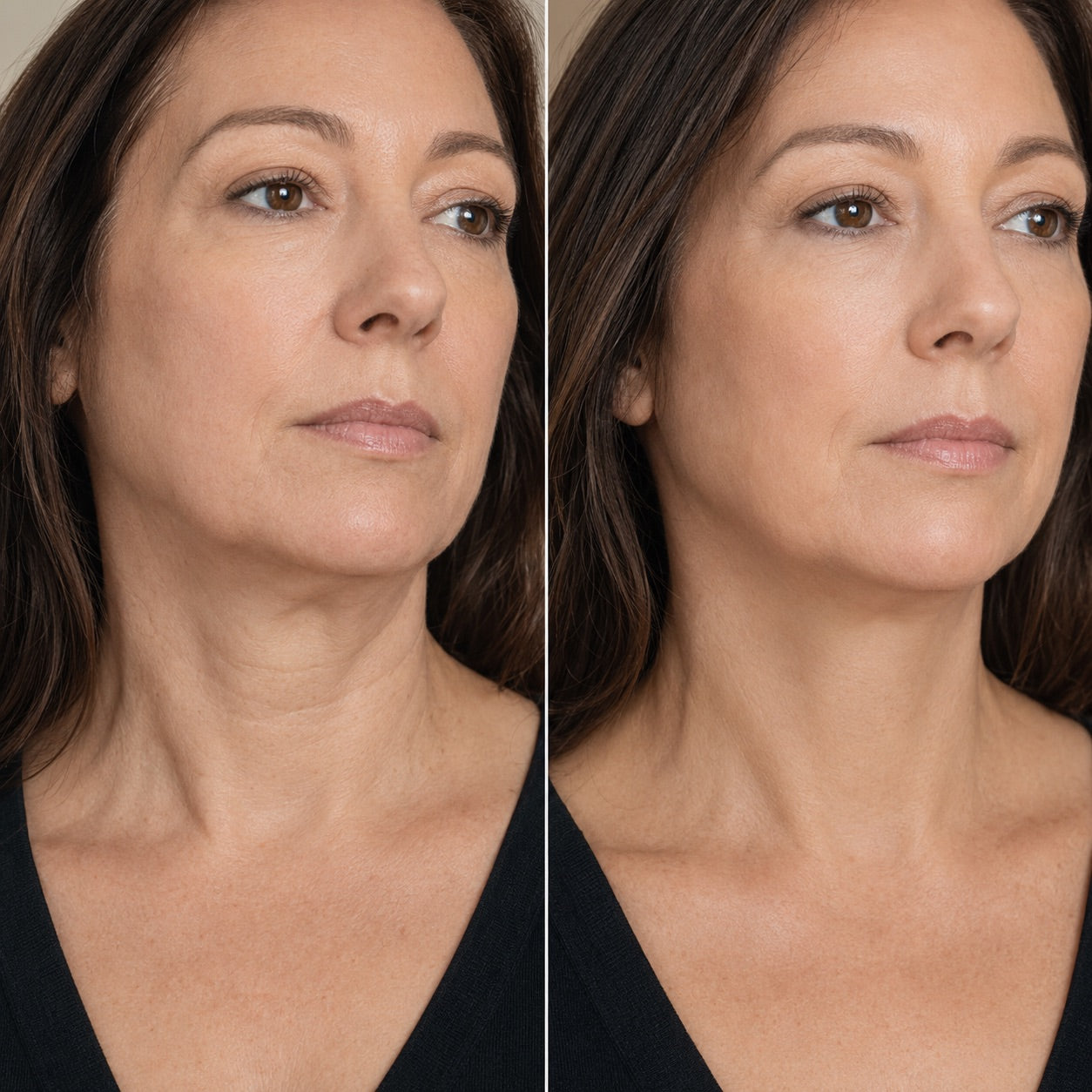Before and after style customer image for under chin and neck support